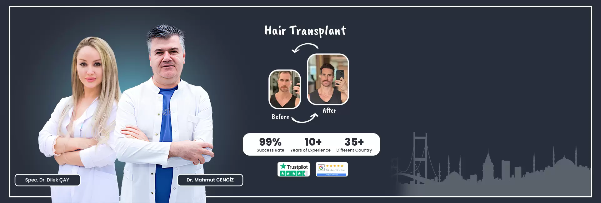 hair transplant turkey