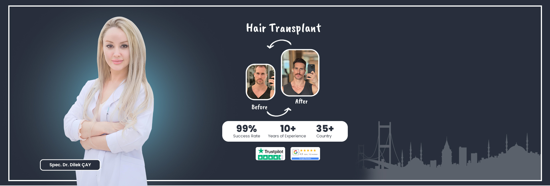 hair transplant turkey